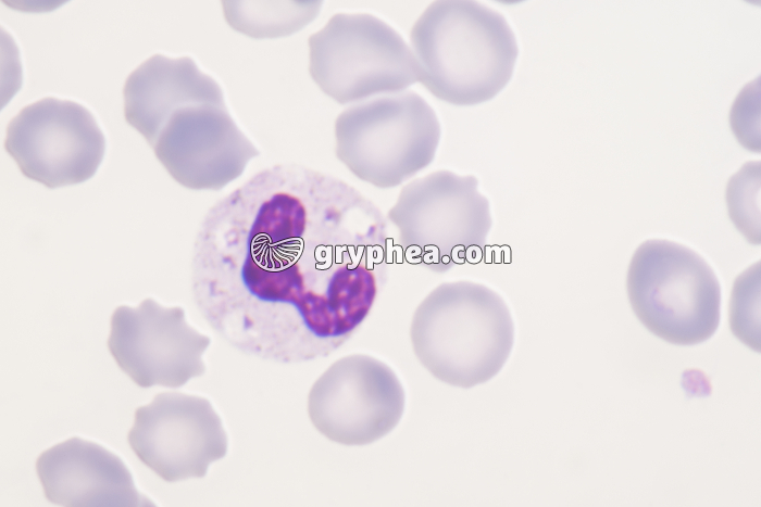 Granulocyte neutrophile x800 - gryphea.org